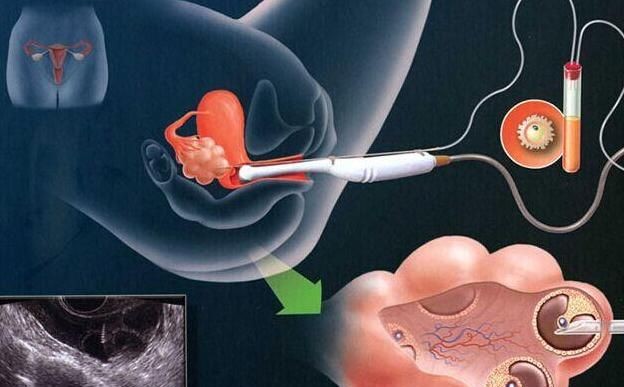 怀孕29周胎儿图孕妇饮食注意事项