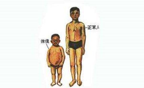 武汉正规助孕产子包生男孩
：软骨发育不全可以通过第三代试管婴儿来预防吗？