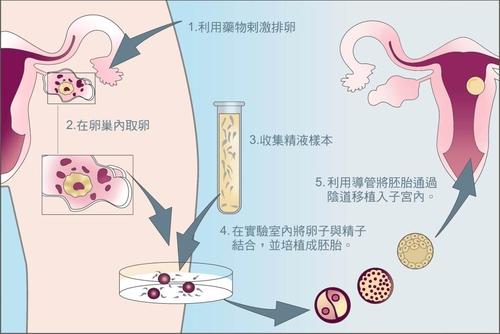 武汉三代试管婴儿医院排名_哪些情况容易导致卵巢性不孕？