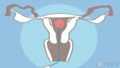 我可以在咸宁市中心医院的生殖科做试管婴儿吗？一个周期的费用是多少？