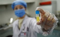 许昌助孕男孩高端机构-泰国试管婴儿：男性精子在体外能存活多长时间？